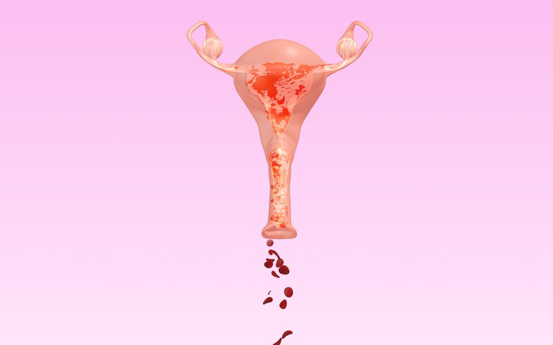 Será que é possível voltar a menstruar dois anos após a menopausa? - iStock